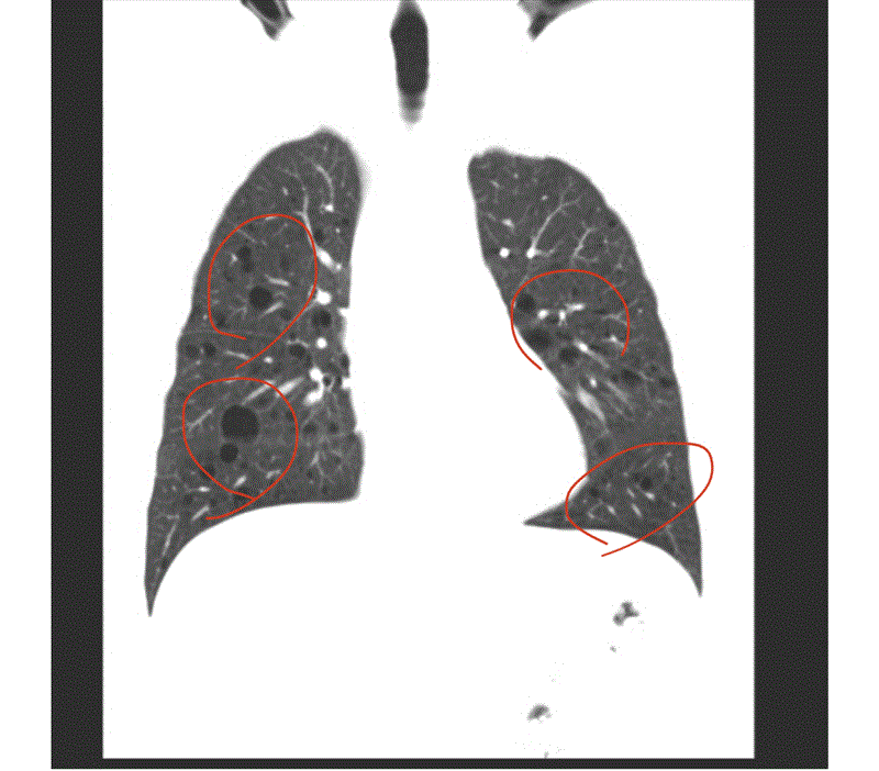 博林胸腔內科診所