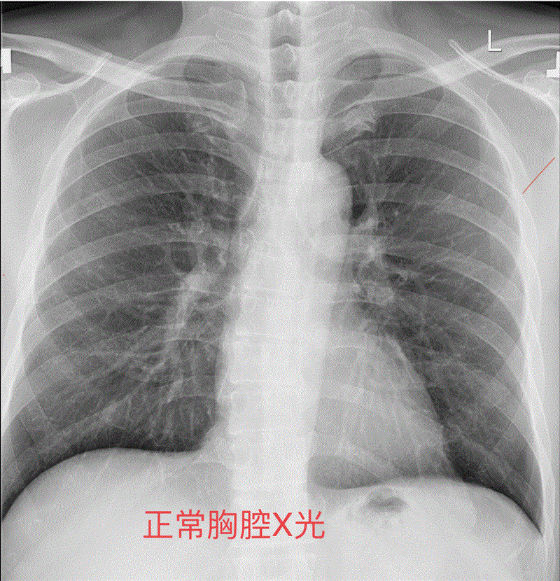 博林胸腔內科診所