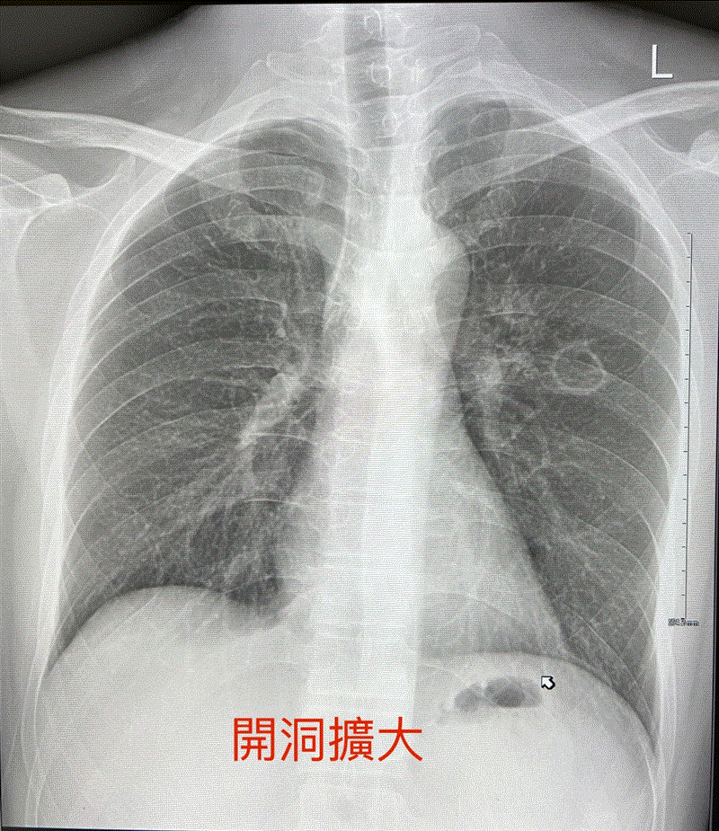 博林胸腔內科診所