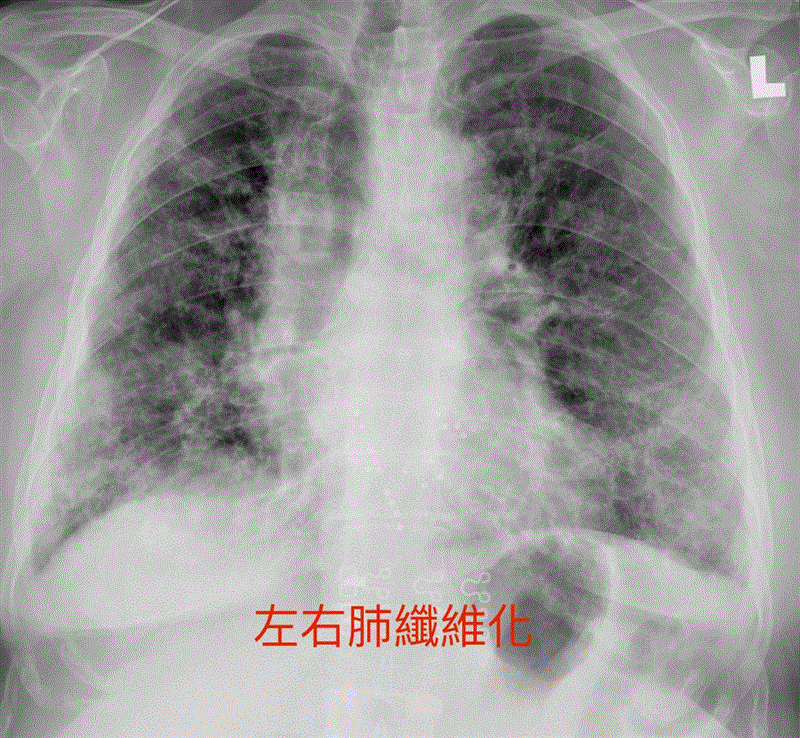 博林胸腔內科診所