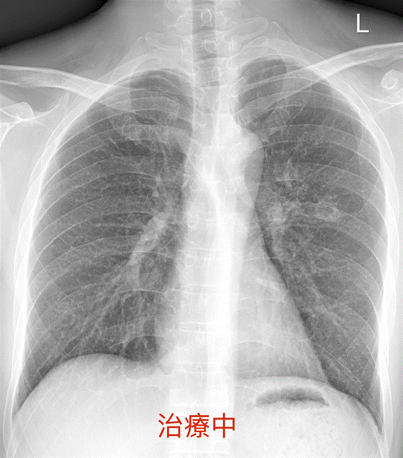 博林胸腔內科診所