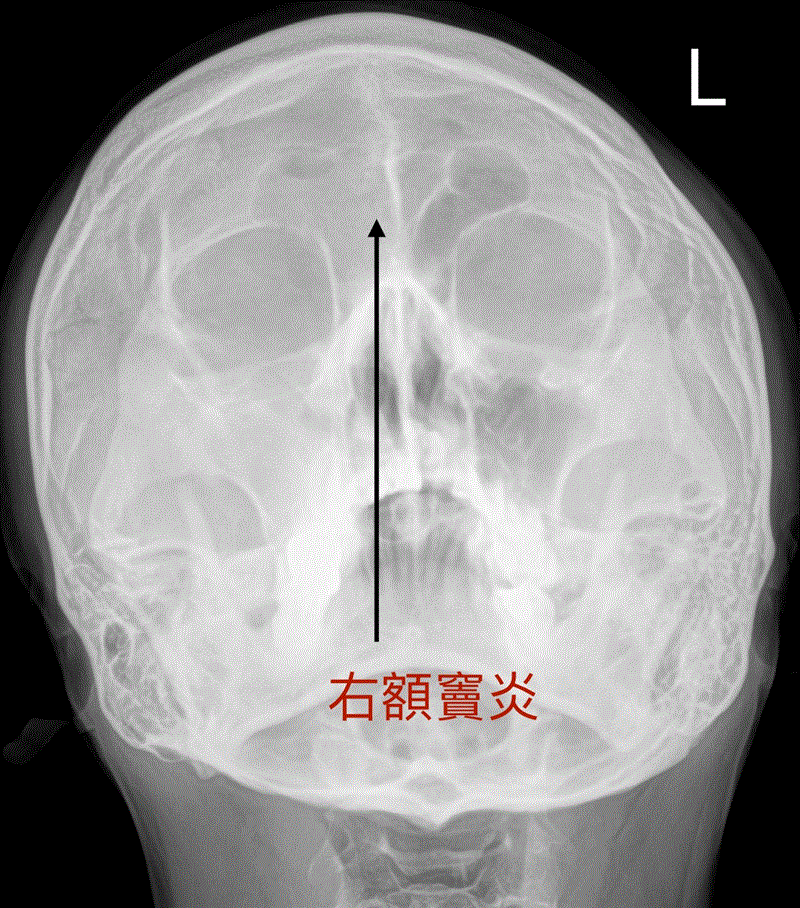 博林胸腔內科診所