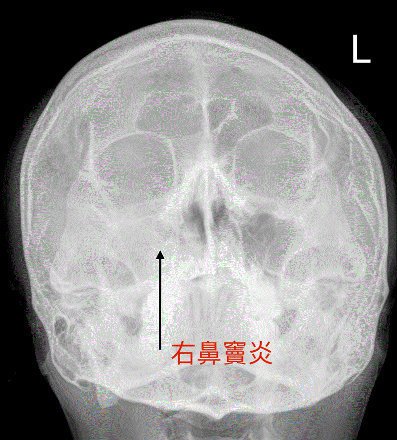 博林胸腔內科診所