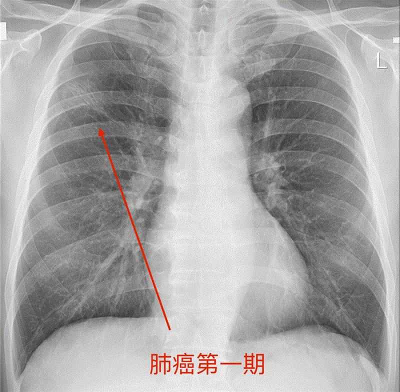 博林胸腔內科診所