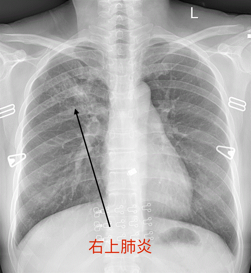 博林胸腔內科診所