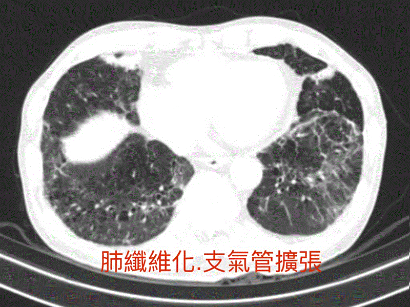 博林胸腔內科診所