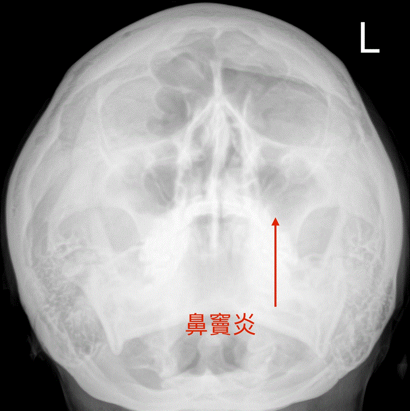 博林胸腔內科診所