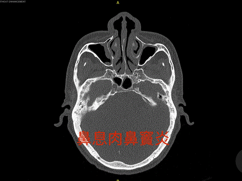 博林胸腔內科診所