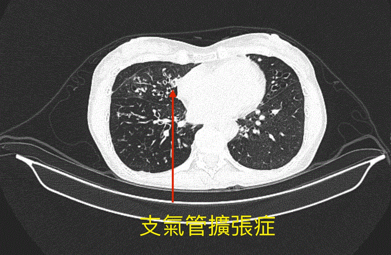 博林胸腔內科診所