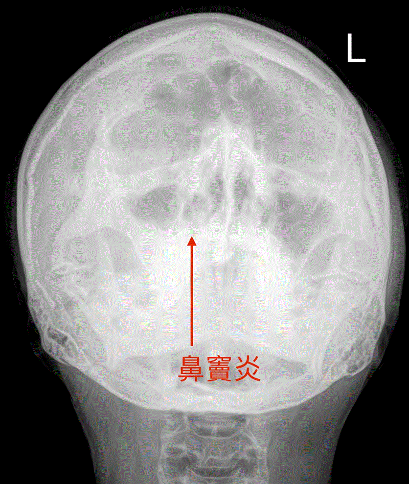 博林胸腔內科診所