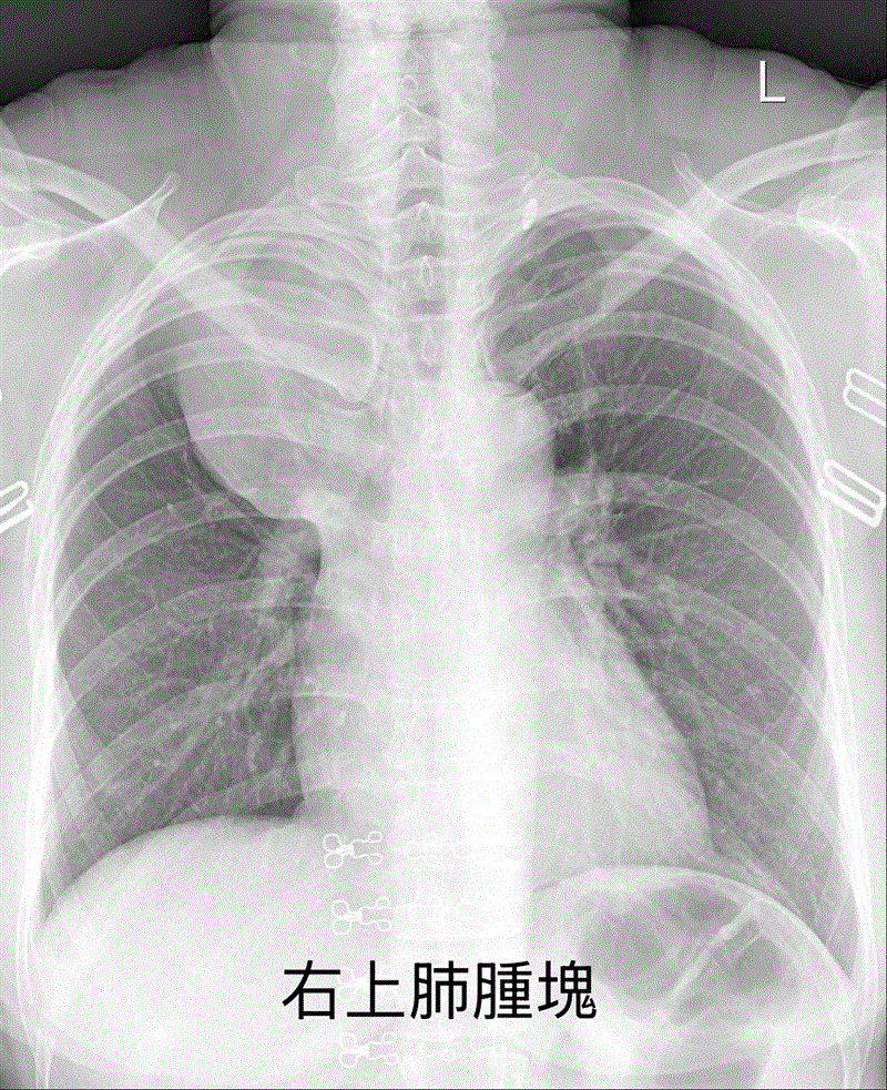 博林胸腔內科診所