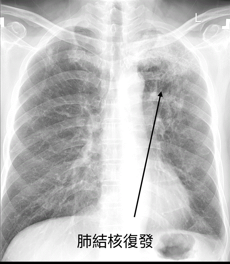 博林胸腔內科診所