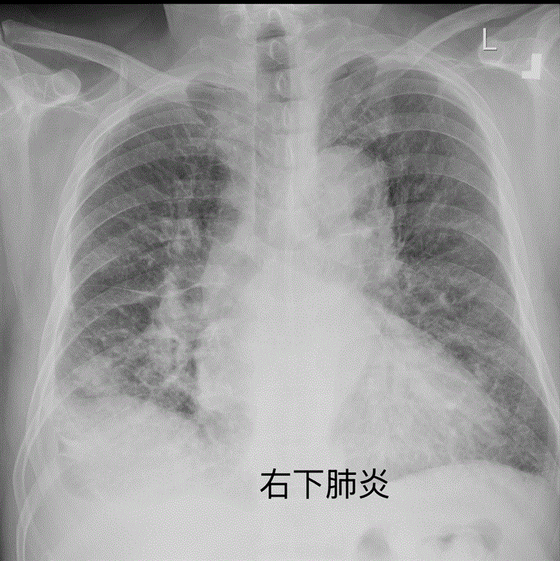 博林胸腔內科診所