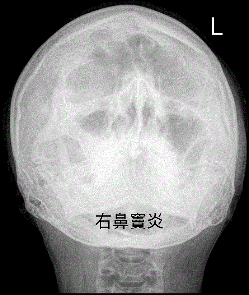 博林胸腔內科診所