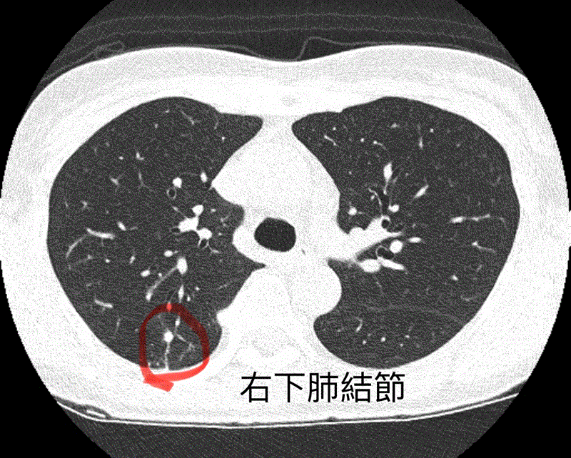 博林胸腔內科診所