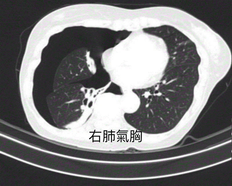 博林胸腔內科診所