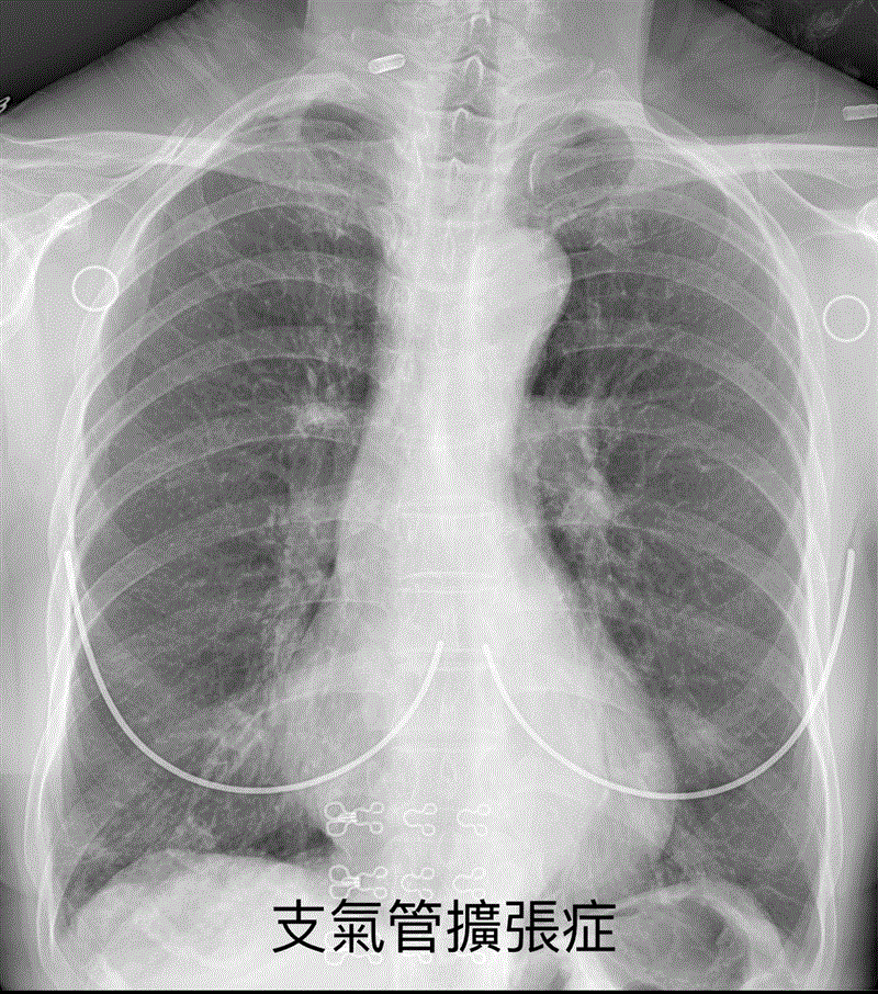 博林胸腔內科診所