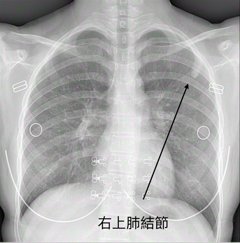 博林胸腔內科診所