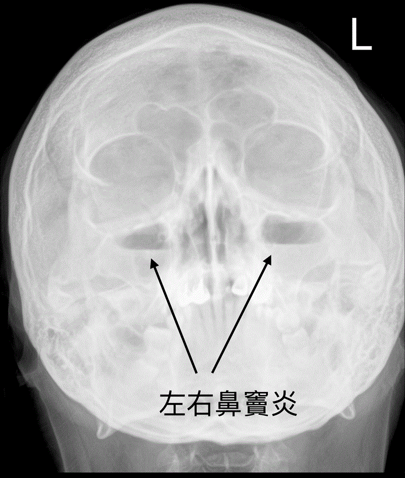 博林胸腔內科診所