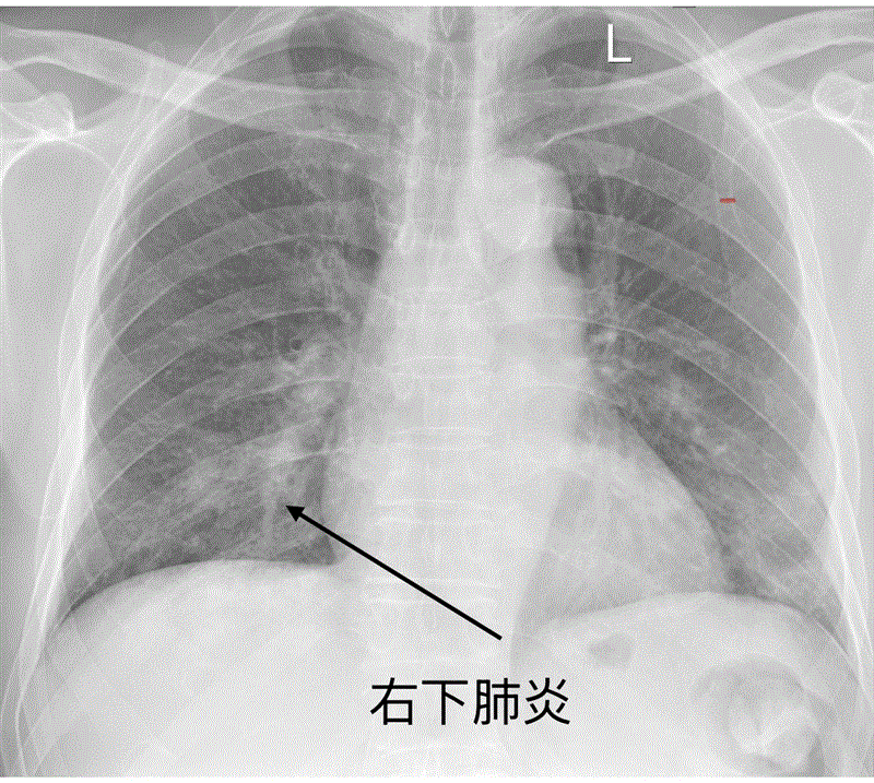 博林胸腔內科診所