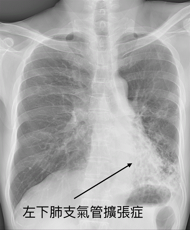 博林胸腔內科診所