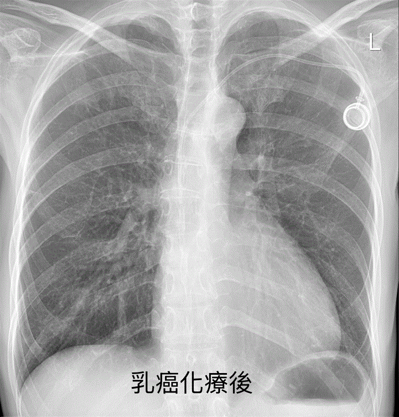 博林胸腔內科診所
