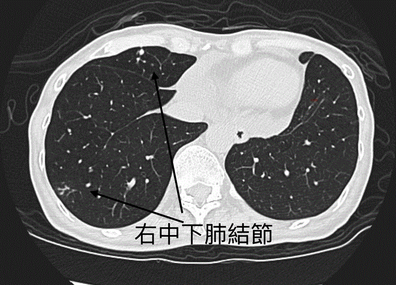 博林胸腔內科診所